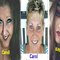 cancar